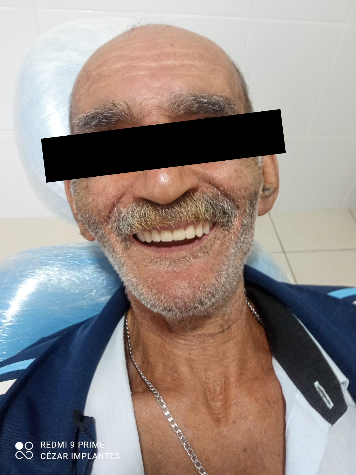 Depois do tratamento